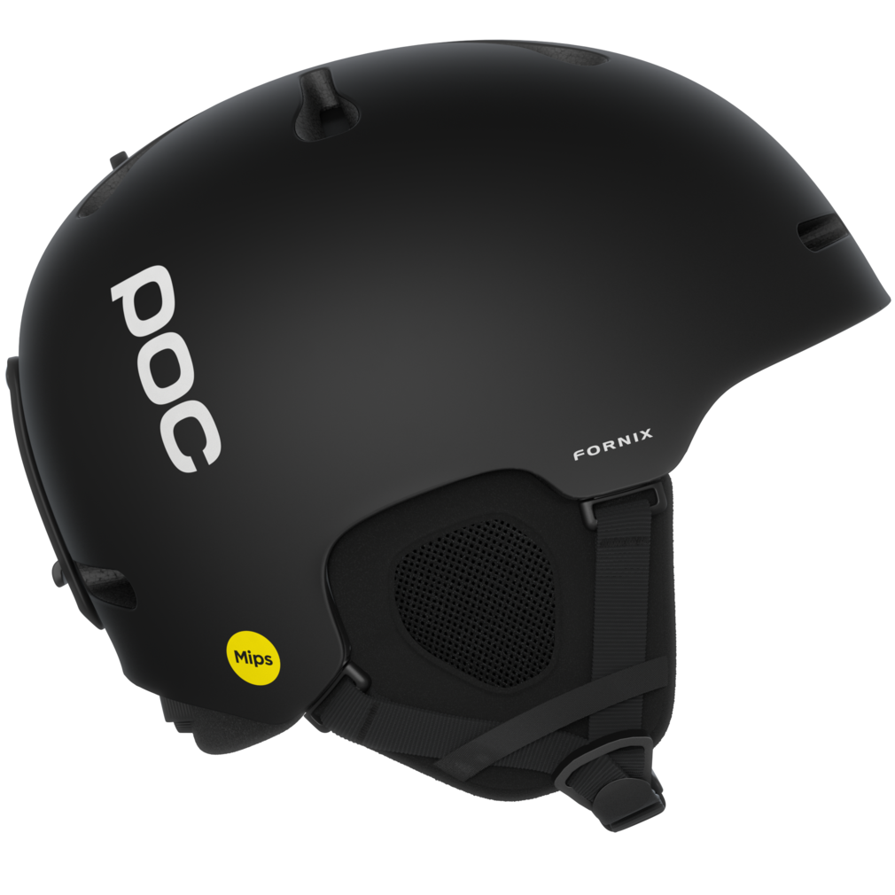 Fornix MIPS alternate view
